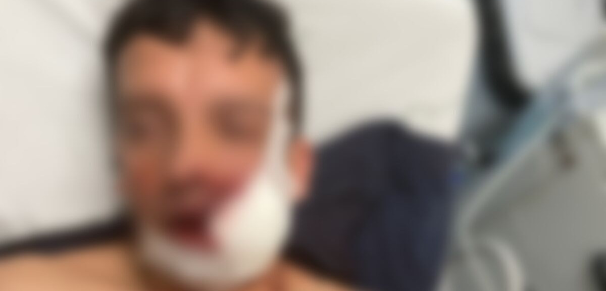 Criminoso acaba baleado após enfrentar policiais do 26º BPM